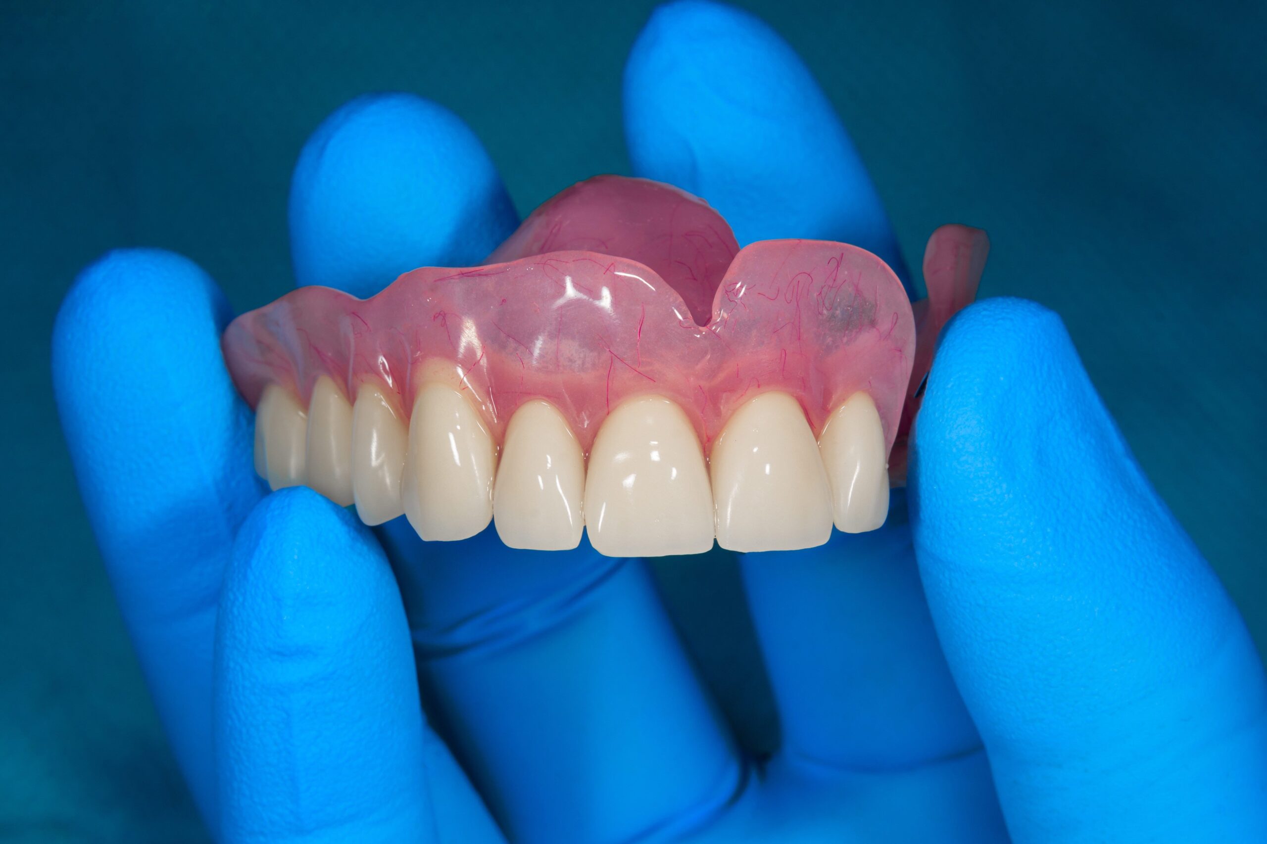 removable-dentures-image