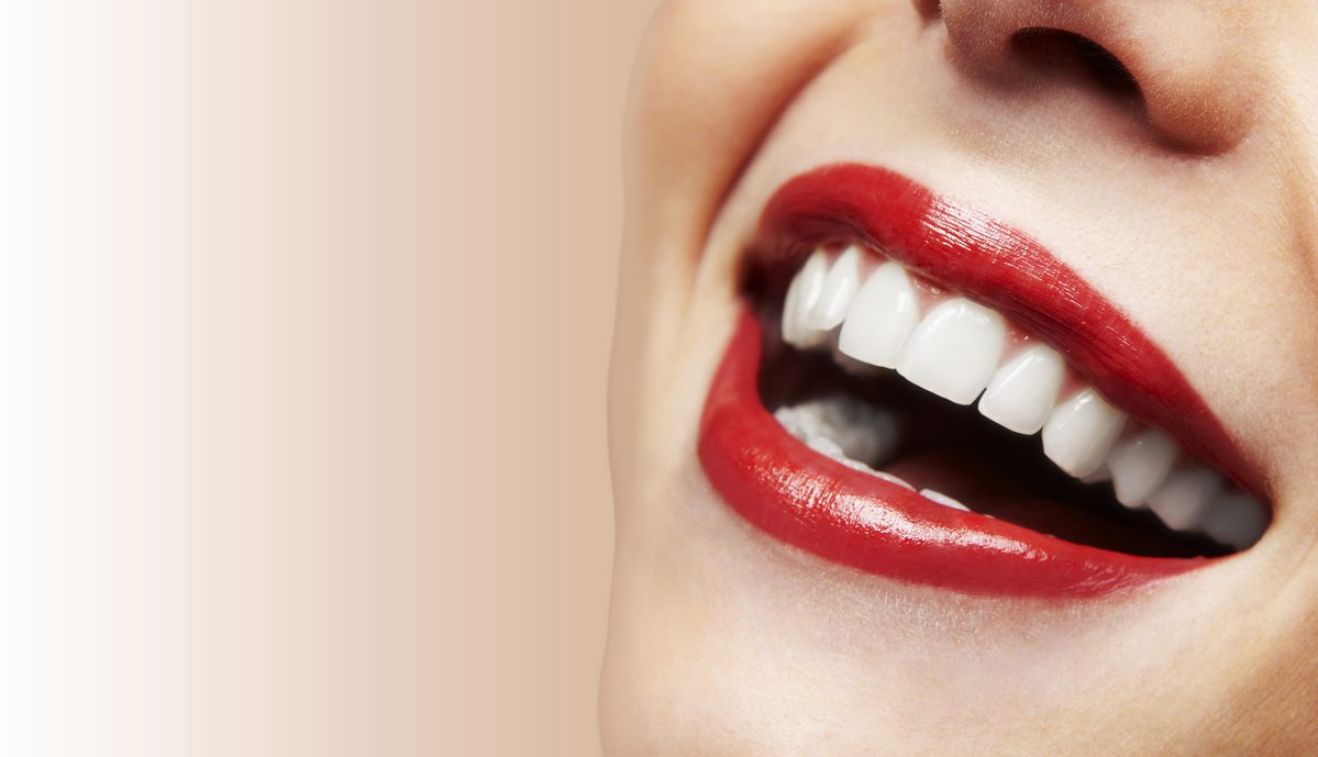 Teeth Whitening - image